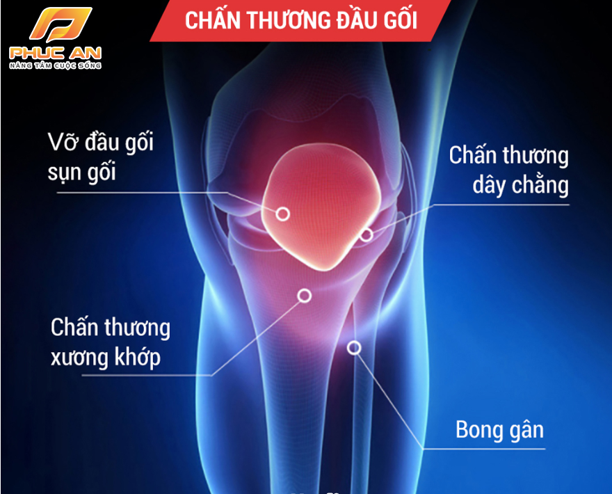 Chấn thương đầu gối